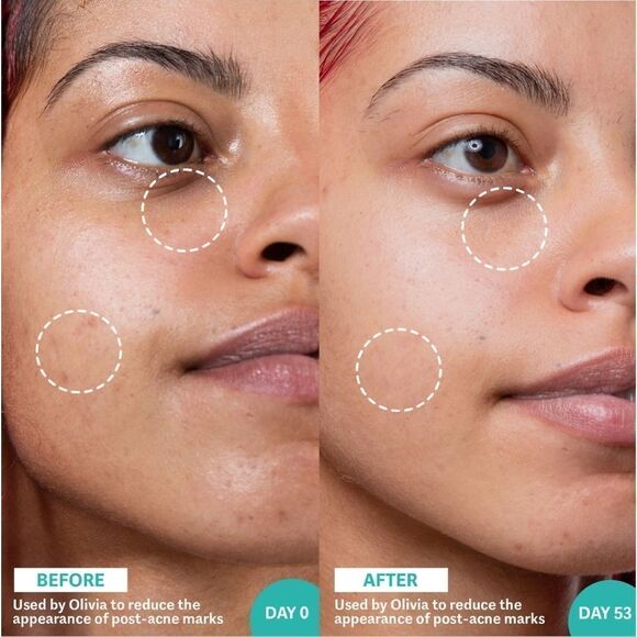 Selfless by Hyram Retinol and Rainbow algae Serum - Picture 3 of 11